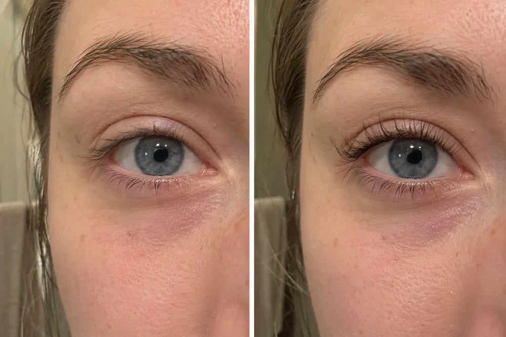 Before and after 12 weeks, after extensions